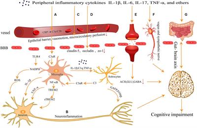 Peripheral inflammation as a potential mechanism and preventive strategy for perioperative neurocognitive disorder under general anesthesia and surgery